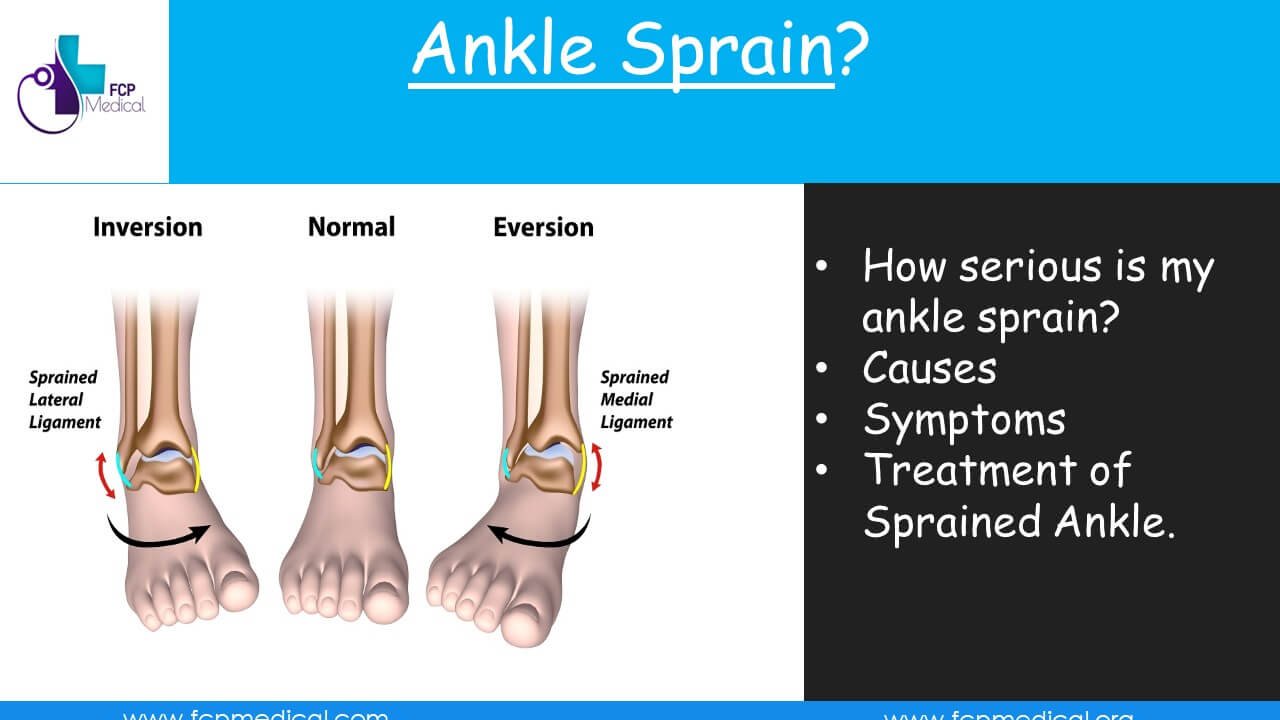 How To Treat Ankle Sprain?